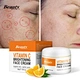 anti aging face cream